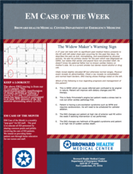 0515 -1 Wellen’s Syndrome on EKG (written by Eugene Popov, MSIV)