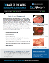 Airway Management, Kerry Fine