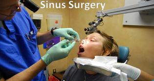 Sinusitis Avoid Sinus Surgery