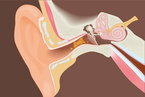 Earwax removal_Ear Cleaning