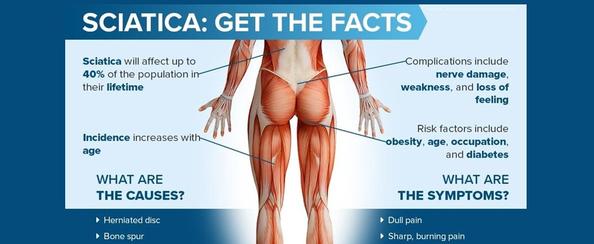 Sciatica Pain: Who can be affected