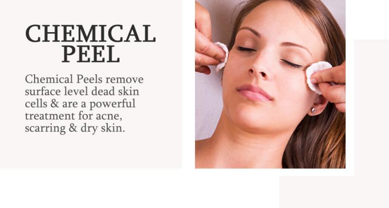 Chemical Peels model. Chemical Peels remove surface level dead skin cells! Find out more below.