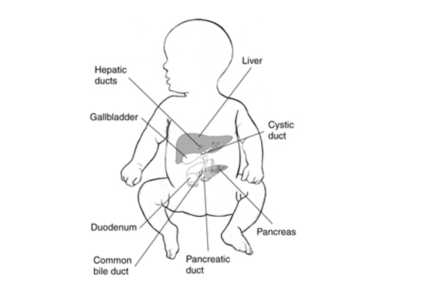 Biliary Atresia - Dr. Joel Wallach