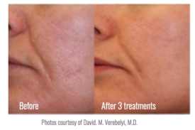 Cosmetic Injectables Center, Encino, Sherman Oaks Botox, Fillers, Restylane, Juvaderm, laser genesis, skin, pigmentation, redness, tightening, wrinkles