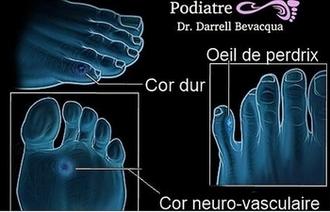 Podiatrist Specialist 25 years of clinical experience.