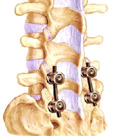 Virginia Brain & Spine Center - Pain Management & Neurosurgery - Spine