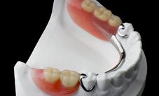 Partial Dentures Michel Puertas Denturologiste Brossard-Laprairie