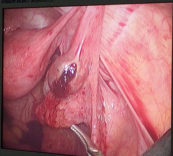 laparoscopy hospital goa