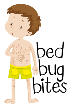 Bed Bug Bites