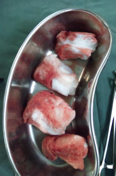 best vaginal surgeon margao