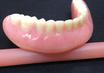 Denture Soft Reline Michel Puertas Denturologiste Brossard-Laprairie