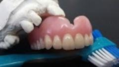 Prothèse Immédiate Michel Puertas Denturologiste Brossard-Laprairie
