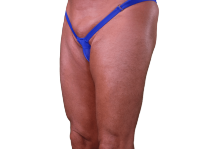 Tucking Swimsuit