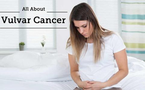 VULVAR CANCER – Causes and Risk Factors, Stages, Clinical Manifestations, Diagnostic Evaluations, Management and Nursing Management