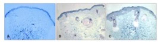 skin, tightening, fine lines, Encino, Cosmetic Injectables Center, PRP, collagen, wrinkles, PRF, Vampire facial, microneedling