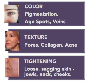 pigmentation, texture, age spots, skin, tightening, collagen, acne, encino, sherman oaks, cosmetic injectables center
