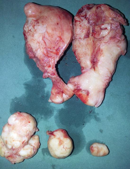 best vaginal surgeon panjim