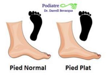 Pied Plat Pied Tombant