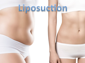 Liposuction VASER PAL Lipocontouring Power-assisted Liposculpting