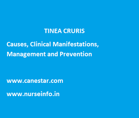 TINEA CRURIS – Causes, Clinical Manifestations, Management and Prevention