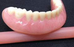 prothèse avec base molle Brossard-Laprairie, denture with soft base Brossard-Laprairie