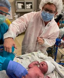 cesarean birth support doula