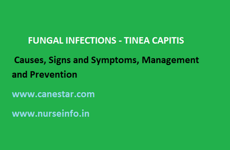 TINEA CAPITIS – Causes, Signs and Symptoms, Management and Prevention