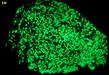 fluorescent Willemite in Kutnohorite - Sterling Hill, New Jersey for sale