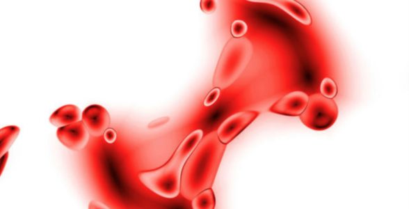 Non Stop Menstrual Bleeding- Dr. Joel Wallach