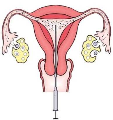 iui specialist goa