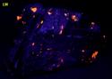 ANNITE with fluorescent SODALITE - Poudrette quarry, Mont Saint Hilaire, Quebec, Canada