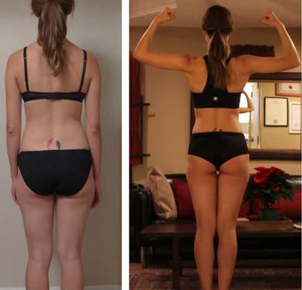 TR90 Weight management