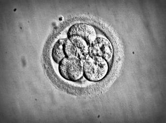 IVF specialist goa