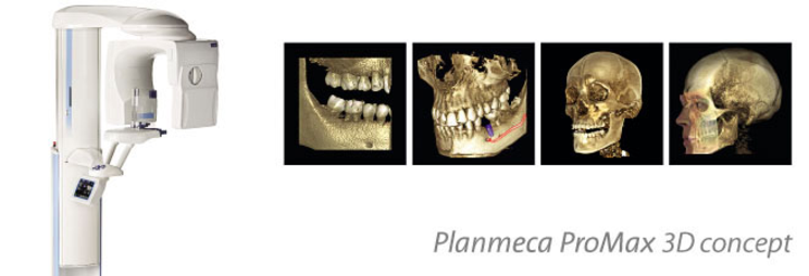 Planmeca ProMax 3D Clinique Implantologie Dentaire Brossard