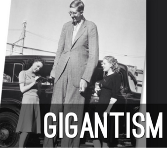 GIGANTISM – Causes and Risk Factors, Clinical Manifestations, Diagnostic Evaluations and Management