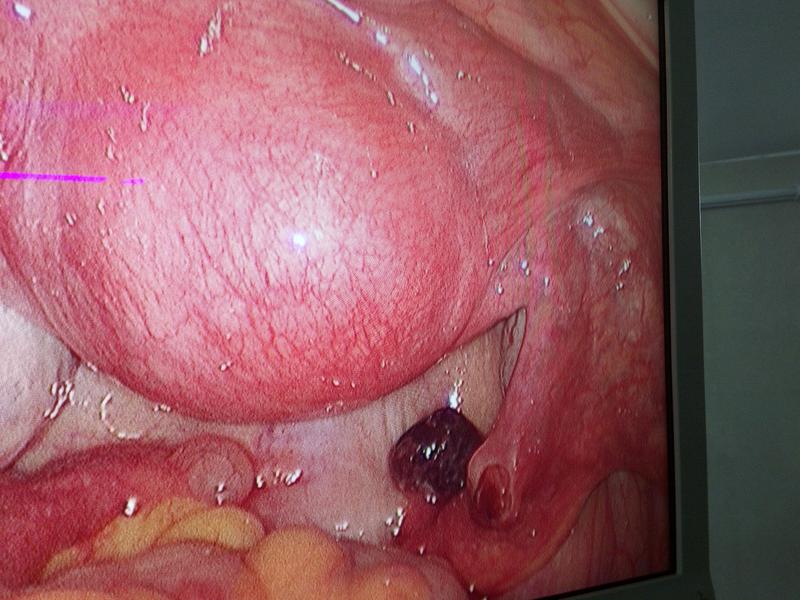 laparoscopy karwar