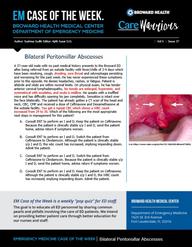 Peritonsillar abscess, bilateral, Sushma Sudhi