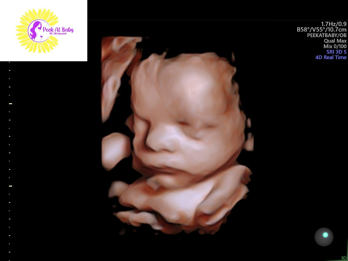 3d/4d sonogram near me