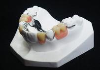 Occlusal Splint Michel Puertas Denturologiste Brossard-Laprairie