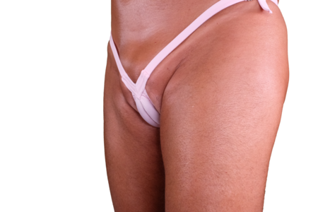 Trans Woman Swimsuit