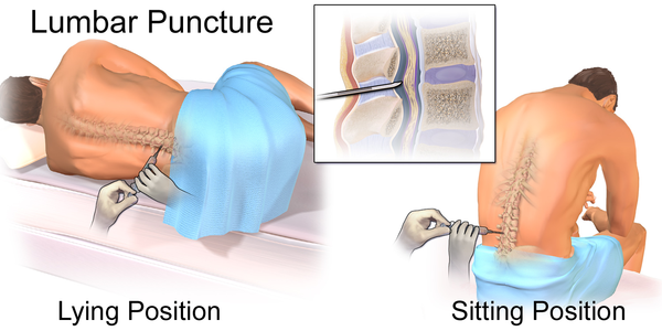 lumbar puncture, site and purpose