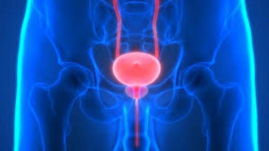 BLADDER CANCER – Causes and Risk Factors, Staging, Clinical Manifestations, Diagnostic Evaluations and Management