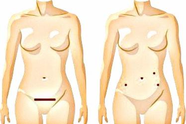 best laparoscopic surgeons in goa