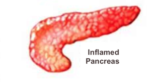 Pancreatitis - Dr. Joel Wallach
