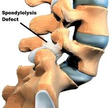 Virginia Brain & Spine Center - Pain Management & Neurosurgery - Spine