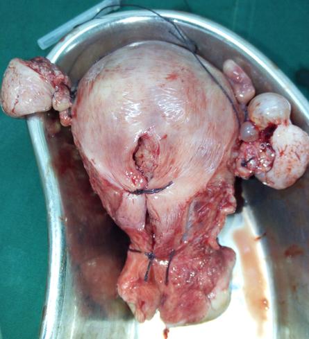 best vaginal surgeon goa