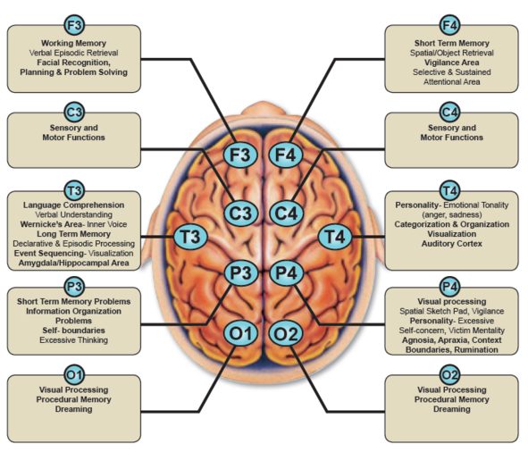 Types Of Brain Mapping - Printable Templates
