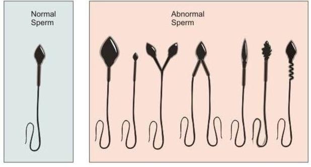 low sperm count goa