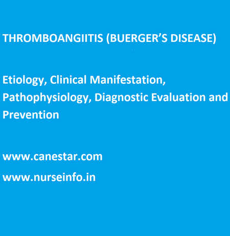 THROMBOANGIITIS (BUERGER’S DISEASE) – Etiology, Clinical Manifestation, Pathophysiology, Diagnostic Evaluation and Prevention