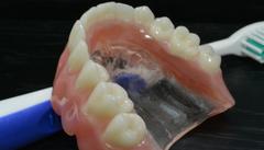 Complete Denture Michel Puertas Denturologiste Brossard-Laprairie